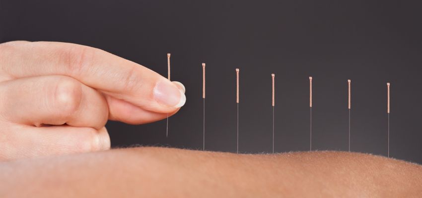 Post Acupuncture Care and Recommendations