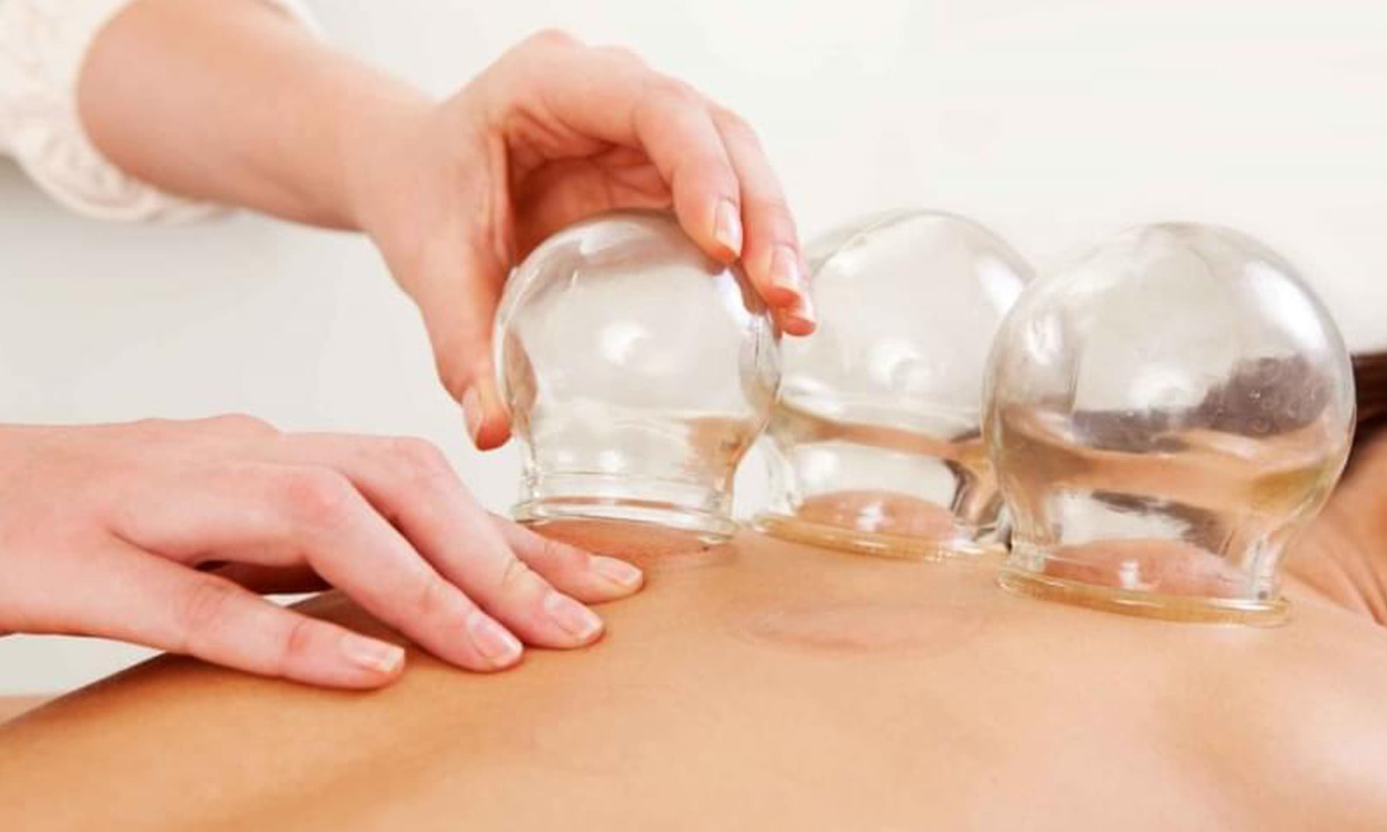 Benefits of Cupping