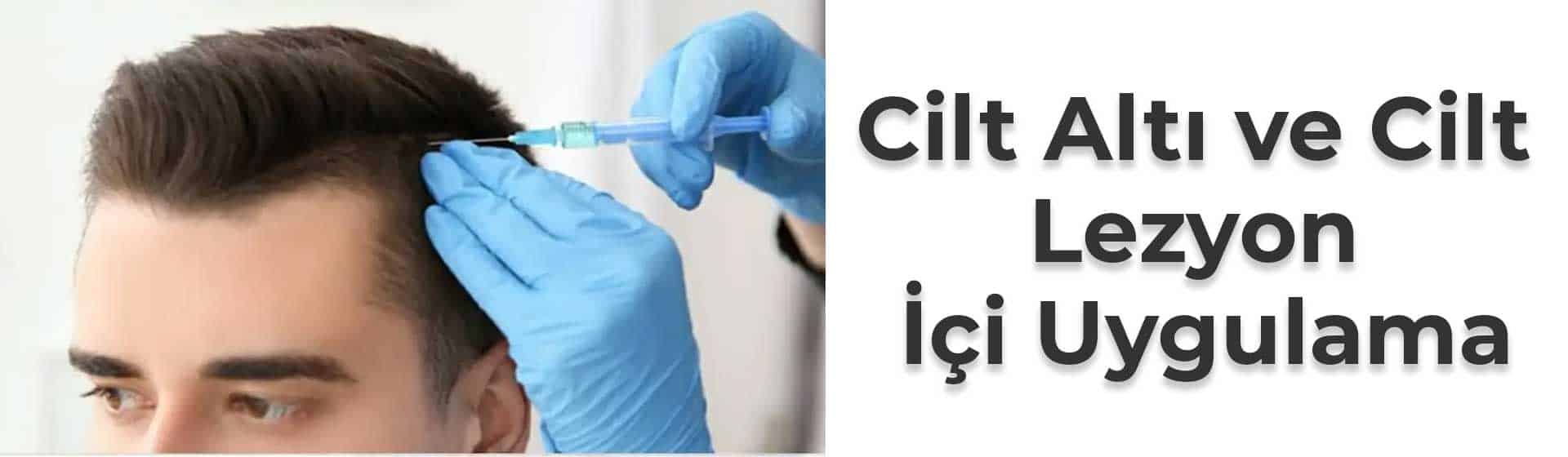 Cilt altı ve Cilt Lezyon İçi Uygulama