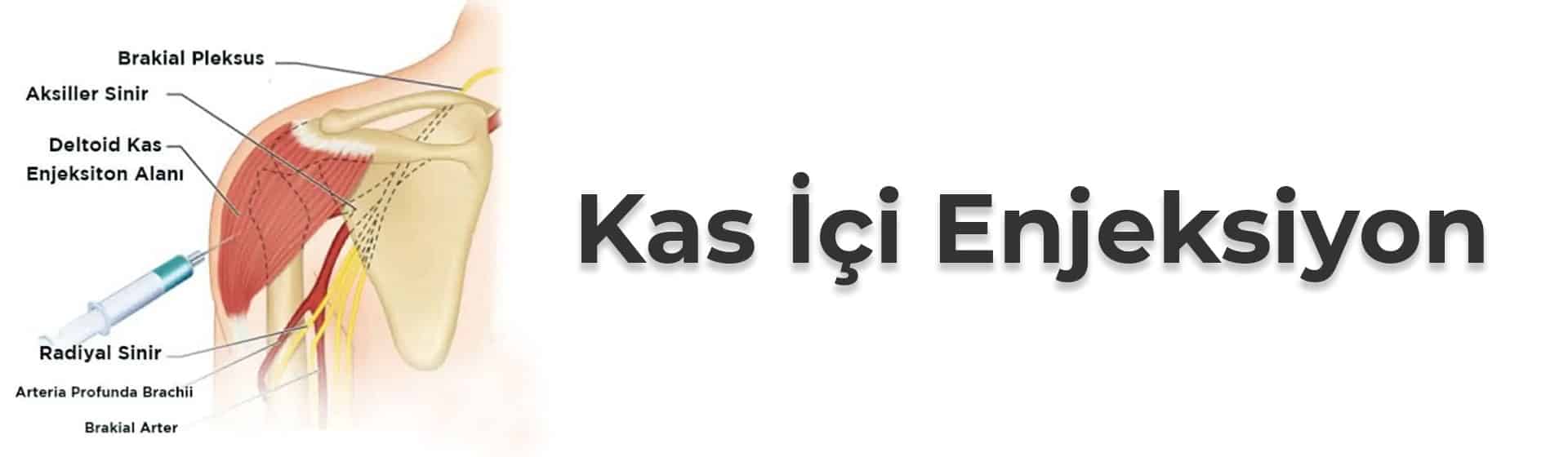 Kas İçi Enjeksiyon